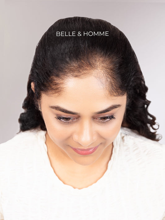 3"x 2" Front Coverage Seamless Hair Patch - Curly